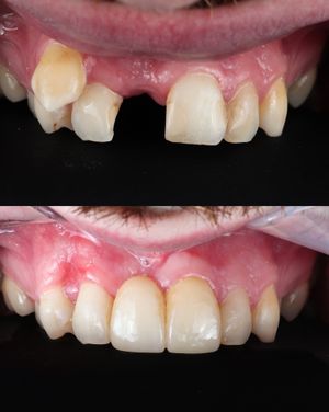 Image post by @fahaddentist on Instagram