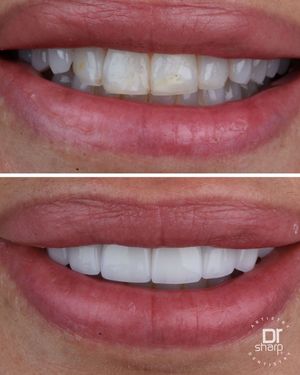 Image post by @sharpdentistry on Instagram