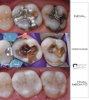 Image post by @dr.maciel_junior on Instagram