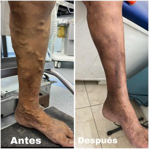 Image post by @dr.vicentevascular on Instagram