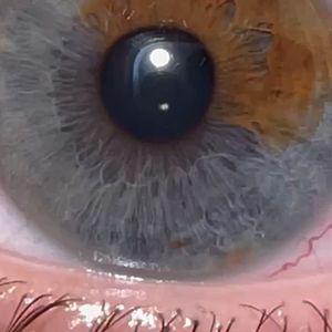 Image post by @irexlaser on Instagram