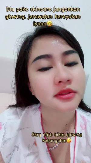 Video post by @lili.refliskin on TikTok