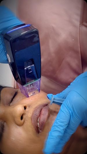 Video post by @nikkybawamedisalonbhopal on Instagram