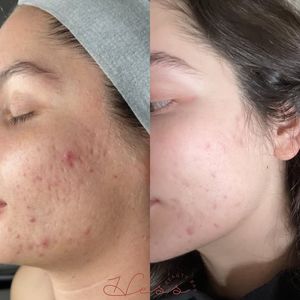 Image post by @HessBeautyBar on Facebook