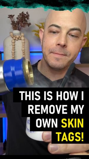 Video post by @drdustinportela on Instagram