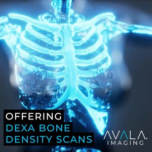 Video post by @avalahealth on Facebook