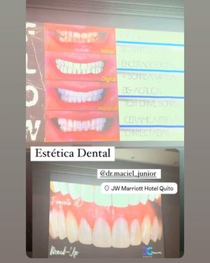 Image post by @dr.maciel_junior on Instagram