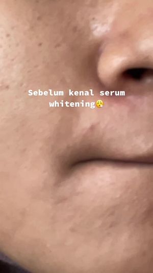 Video post by @lili.refliskin on TikTok
