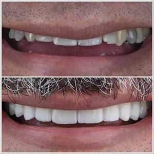 Image post by @sharpdentistry on Instagram
