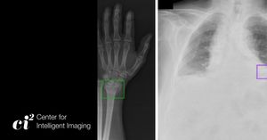 Image post by @UCSF_Ci2 on Twitter/X