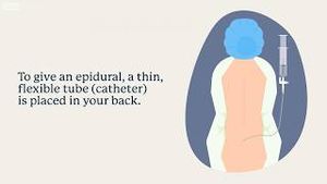 Video post by @uclahealth on YouTube
