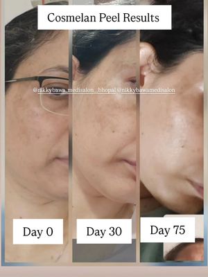 Image post by @nikkybawamedisalonbhopal on Instagram