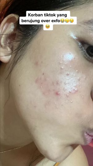 Video post by @sindi9rande on TikTok