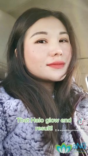 Video post by @anuaestheticsandwellness on Instagram