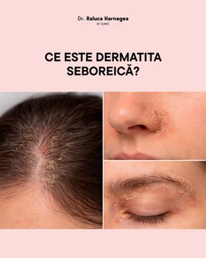 Image post by @dr.ralucaharnagea on Instagram