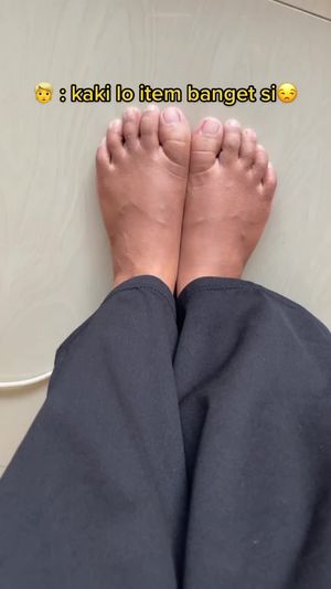 Video post by @lili.refliskin on TikTok