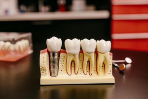 Image post by @nobscotdentalcare1 on Instagram