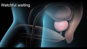 Video post by @nucleusmedicalmedia on YouTube