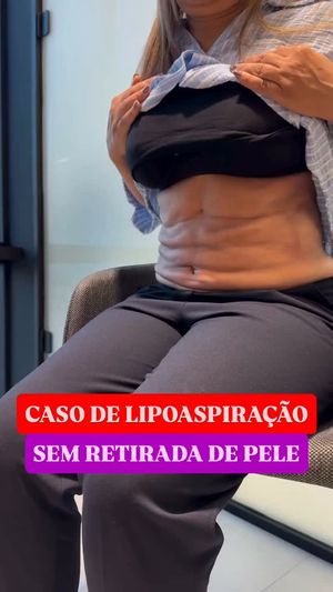 Video post by @drpresperd on Instagram