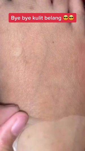 Video post by @lili.refliskin on TikTok