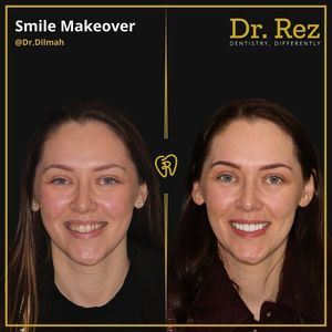 Image post by @drrezdental on Facebook