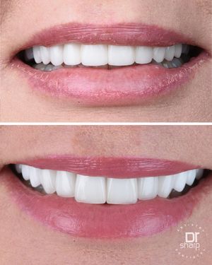 Image post by @sharpdentistry on Instagram