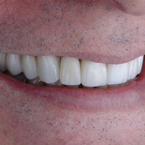 Image post by @sharpdentistry on Instagram