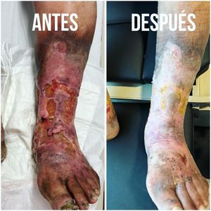 Image post by @dr.vicentevascular on Instagram