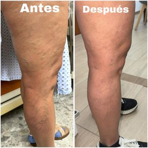 Image post by @dr.vicentevascular on Instagram