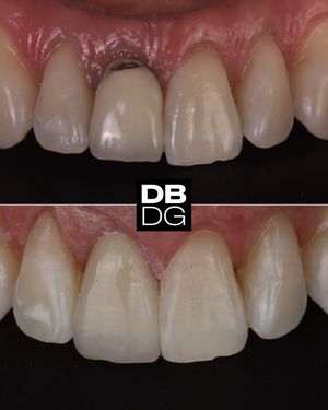 Image post by @drdelfinbarquero on Instagram