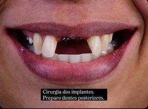 Image post by @danielcoutinhodentista on Instagram