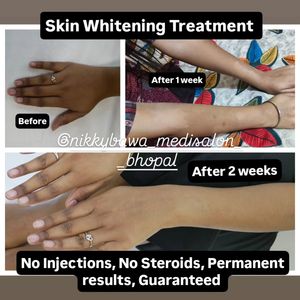 Image post by @nikkybawamedisalonbhopal on Instagram
