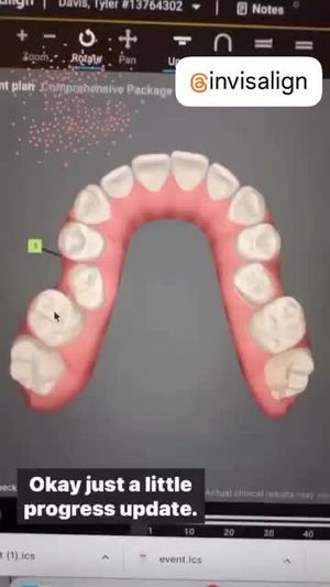Video post by @weisstorortho on TikTok