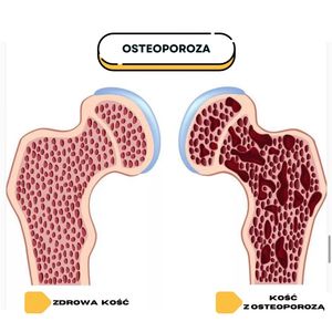 Image post by @neurochirurg_litak on Instagram
