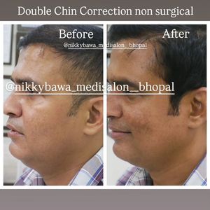 Image post by @nikkybawamedisalonbhopal on Instagram