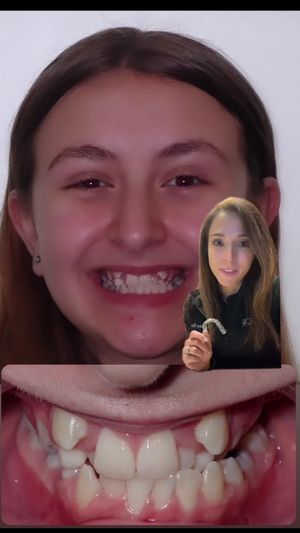 Video post by @weisstorortho on TikTok