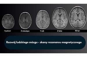Image post by @neurochirurg_litak on Instagram