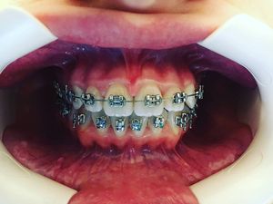 Image post by @dentamerzifon on Instagram