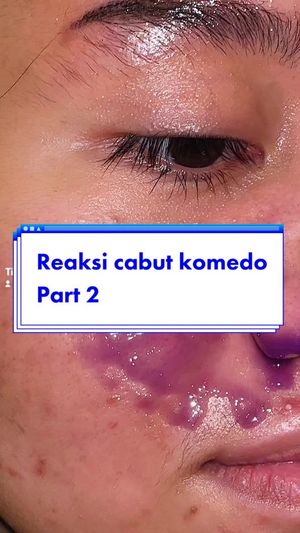 Video post by @sangasyahriani on TikTok