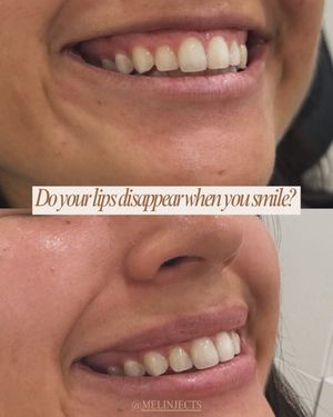 Image post by @melinjects on Instagram