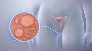Video post by @nucleusmedicalmedia on YouTube
