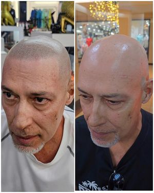 Image post by @scalpclinicpr on Instagram
