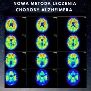 Image post by @neurochirurg_litak on Instagram