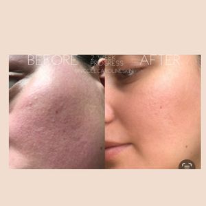 Image post by @nicolecarolineskin on Instagram