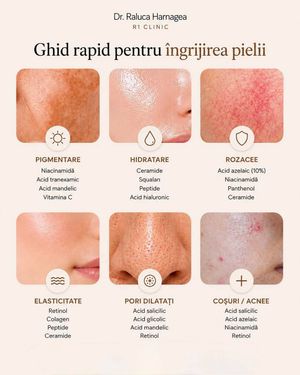 Image post by @dr.ralucaharnagea on Instagram