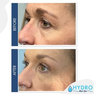 Image post by @hydromedspa on Facebook