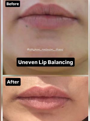 Image post by @nikkybawamedisalonbhopal on Instagram