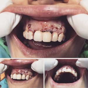 Image post by @dr.davidgarciadds on Instagram