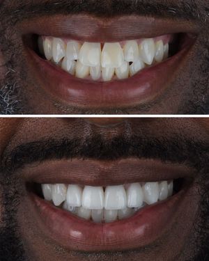 Image post by @sharpdentistry on Instagram