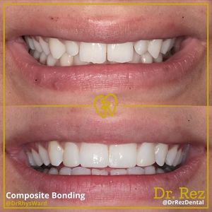 Image post by @drrezdental on Facebook